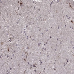 NT-3 Antibody, Novus Biologicals 0.1mL; Unlabeled:Antibodies, Polyclonal